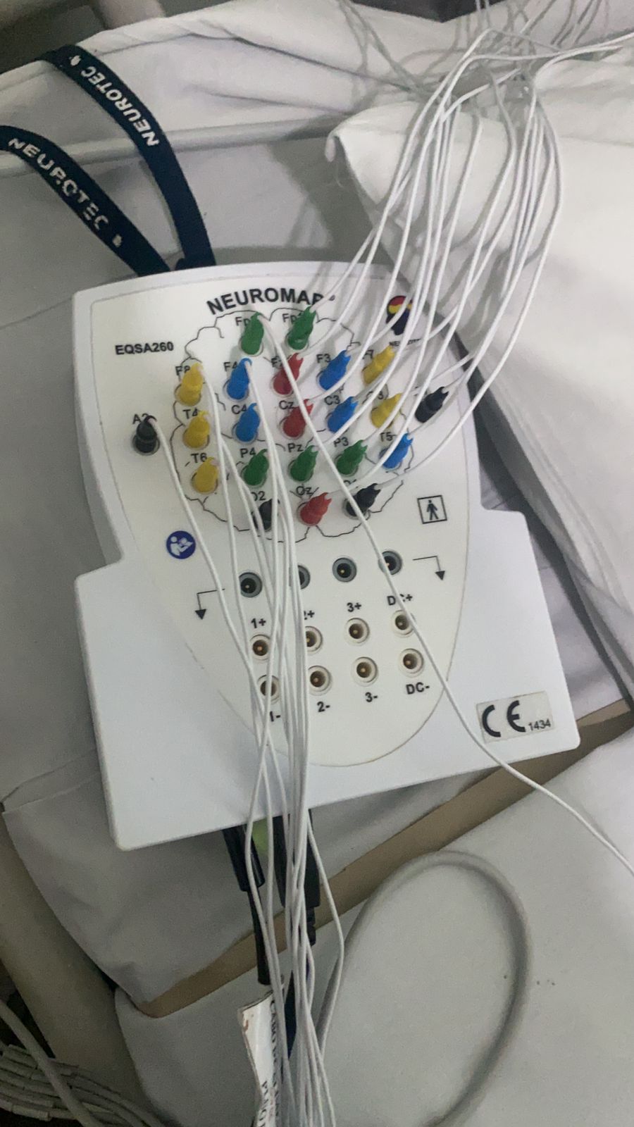 Equipamento de vídeo-EEG Neuromap com eletrodos preparados para o exame domiciliar